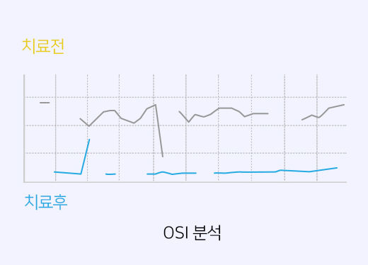 눈물막 분석검사 (OSI 분석) 이미지